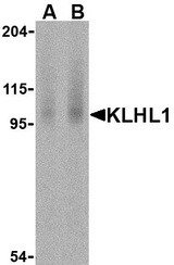 Western blot of KLHL1 in Human brain cell lysate with KLHL1 antibody at (A) 2 and (B) 4 g/ml.