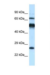 KLHL1 antibody LS-C145537 Western blot of Rat Brain lysate. Antibody concentration 1 ug/ml.