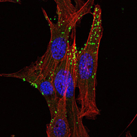 Immunofluorescence of NIH/3T3 cells using KLHL1 mouse monoclonal antibody (green). Red: Actin filaments have been labeled with Alexa Fluor-555 phalloidin.