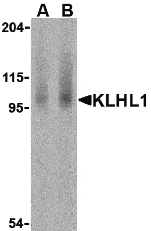 Western blot of KLHL1 in human brain cell lysate with KLHL1 antibody at (A) 2 and (B) 4 ug /ml.