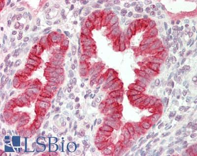 Human Uterus: Formalin-Fixed, Paraffin-Embedded (FFPE)