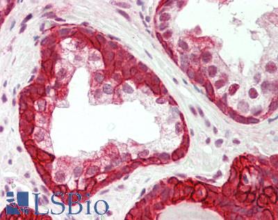 Human Prostate: Formalin-Fixed, Paraffin-Embedded (FFPE)