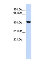 KRT19 / Cytokeratin 19 antibody western blot of Human Fetal Lung lysate.
