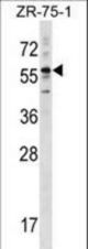 KRT3 Antibody western blot of ZR-75-1 cell line lysates (35 ug/lane). The KRT3 antibody detected the KRT3 protein (arrow).