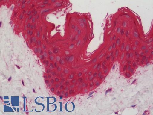 Human Skin: Formalin-Fixed, Paraffin-Embedded (FFPE)