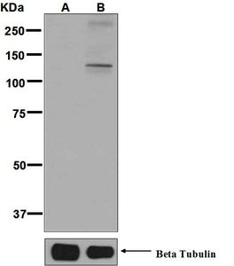 Western blot analysis on 293T cell lysates using anti-Phospho-KSR1 (pS392) antibody. Cells were either (A) untreated or (B) treated with Calyculin A.