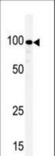 Western blot of anti-KSR1 antibody in T47D cell line lysate. KSR1(arrow) was detected using the purified antibody.