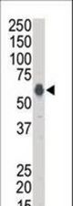 Western blot of anti-KSR1 antibody in A375 cell lysate. KSR1 (arrow) was detected using purified antibody. Secondary HRP-anti-rabbit was used for signal visualization with chemiluminescence.