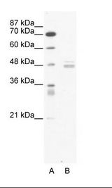 A: Marker, B: Jurkat Cell Lysate