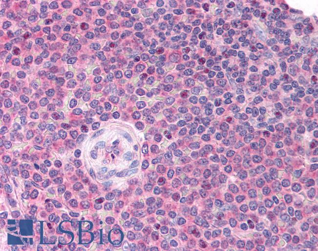 Anti-LDB1 antibody IHC of human spleen. Immunohistochemistry of formalin-fixed, paraffin-embedded tissue after heat-induced antigen retrieval. Antibody LS-B983 concentration 5 ug/ml.