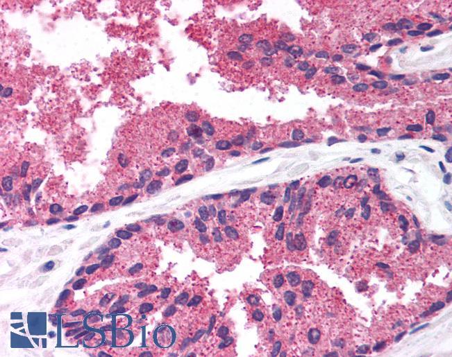Anti-LDB1 antibody IHC of human prostate. Immunohistochemistry of formalin-fixed, paraffin-embedded tissue after heat-induced antigen retrieval. Antibody LS-B983 concentration 5 ug/ml.