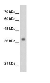 HepG2 Cell Lysate