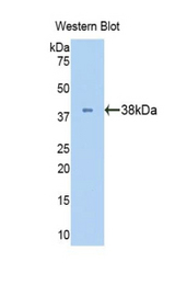Western blot of recombinant LDHB / LDH-B.