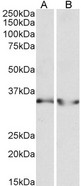 LDHB antibody (0.3 ug/ml) staining of Human Heart (A) and Human Kidney (B) lysates (35 ug protein in RIPA buffer). Primary incubation was 1 hour. Detected by chemiluminescence.
