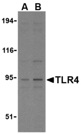 Western blot of TLR4 in PC-3 cell lysates with TLR4 antibody at (A) 2.5 and (B) 5 ug/ml.