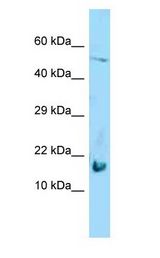 GAL7 / Galectin 7 antibody Western Blot of HepG2.