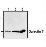 Western blot of GAL7 / Galectin-7 antibody LS-C147148.