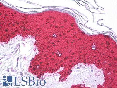 Anti-GAL7 / Galectin-7 antibody IHC of human skin, epidermis. Immunohistochemistry of formalin-fixed, paraffin-embedded tissue after heat-induced antigen retrieval. Antibody LS-B7797 dilution 1:50.