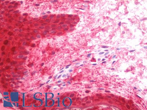 Anti-LGALS7 / Galectin 7 antibody IHC staining of human skin. Immunohistochemistry of formalin-fixed, paraffin-embedded tissue after heat-induced antigen retrieval. Antibody LS-B11436 concentration 5 ug/ml.