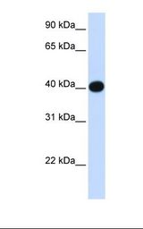 Fetal muscle lysate. Antibody concentration: 1.0 ug/ml. Gel concentration: 12%.