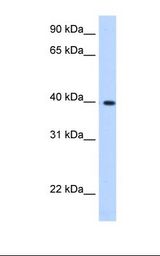 LN 18 cell lysate. Antibody concentration: 0.25 ug/ml. Gel concentration: 12%.