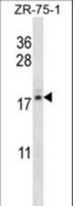 TNP2 Antibody western blot of ZR-75-1 cell line lysates (35 ug/lane). The TNP2 antibody detected the TNP2 protein (arrow).