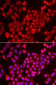 Immunofluorescence analysis of U2OS cell using TNP2 antibody. Blue: DAPI for nuclear staining.
