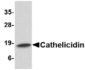 Western blot of Cathelicidin in Human spleen tissue lysate with Cathelicidin antibody at 1 ug/ml.