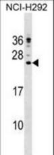 CAMP Antibody western blot of NCI-H292 cell line lysates (35 ug/lane). The CAMP antibody detected the CAMP protein (arrow).