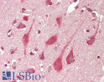 Human Brain, Cortex: Formalin-Fixed, Paraffin-Embedded (FFPE)