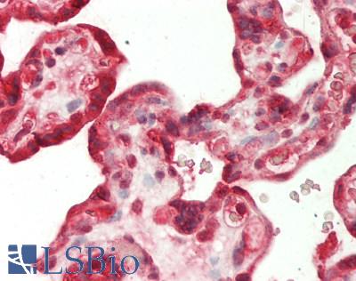Human Placenta: Formalin-Fixed, Paraffin-Embedded (FFPE)