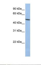 HepG2 cell lysate. Antibody concentration: 1.0 ug/ml. Gel concentration: 12%.