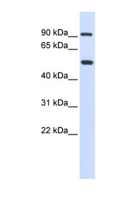 LOXL1 antibody LS-C110889 Western blot of Fetal Lung lysate.
