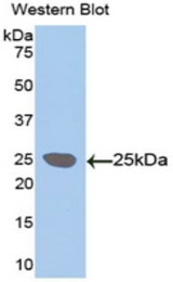 Western blot of recombinant LOXL / LOXL1.