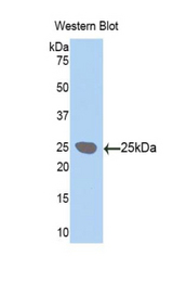 Western blot of recombinant LOXL / LOXL1.