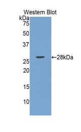 Western blot of recombinant LOXL / LOXL1.