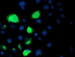 Anti-LPL mouse monoclonal antibody immunofluorescent staining of COS7 cells transiently transfected by pCMV6-ENTRY LPL.