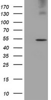 HEK293T cells were transfected with the pCMV6-ENTRY control (Left lane) or pCMV6-ENTRY LPL (Right lane) cDNA for 48 hrs and lysed. Equivalent amounts of cell lysates (5 ug per lane) were separated by SDS-PAGE and immunoblotted with anti-LPL.