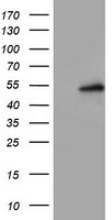 HEK293T cells were transfected with the pCMV6-ENTRY control (Left lane) or pCMV6-ENTRY LPL (Right lane) cDNA for 48 hrs and lysed. Equivalent amounts of cell lysates (5 ug per lane) were separated by SDS-PAGE and immunoblotted with anti-LPL.