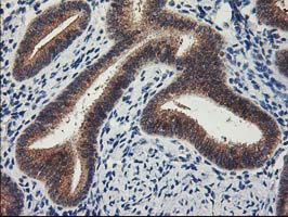 IHC of paraffin-embedded Human endometrium tissue using anti-LPL mouse monoclonal antibody.