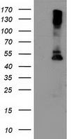 HEK293T cells were transfected with the pCMV6-ENTRY control (Left lane) or pCMV6-ENTRY LPL (Right lane) cDNA for 48 hrs and lysed. Equivalent amounts of cell lysates (5 ug per lane) were separated by SDS-PAGE and immunoblotted with anti-LPL.