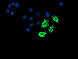 Anti-LPL mouse monoclonal antibody immunofluorescent staining of COS7 cells transiently transfected by pCMV6-ENTRY LPL.