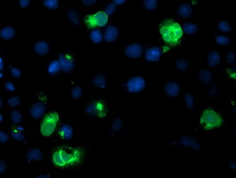 Anti-LPL mouse monoclonal antibody immunofluorescent staining of COS7 cells transiently transfected by pCMV6-ENTRY LPL.