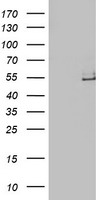 HEK293T cells were transfected with the pCMV6-ENTRY control (Left lane) or pCMV6-ENTRY LPL (Right lane) cDNA for 48 hrs and lysed. Equivalent amounts of cell lysates (5 ug per lane) were separated by SDS-PAGE and immunoblotted with anti-LPL.