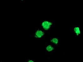 Anti-LPL mouse monoclonal antibody immunofluorescent staining of COS7 cells transiently transfected by pCMV6-ENTRY LPL.