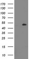 HEK293T cells were transfected with the pCMV6-ENTRY control (Left lane) or pCMV6-ENTRY LPL (Right lane) cDNA for 48 hrs and lysed. Equivalent amounts of cell lysates (5 ug per lane) were separated by SDS-PAGE and immunoblotted with anti-LPL.