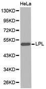 Western blot analysis of extracts of HeLa cell line, using LPL antibody.