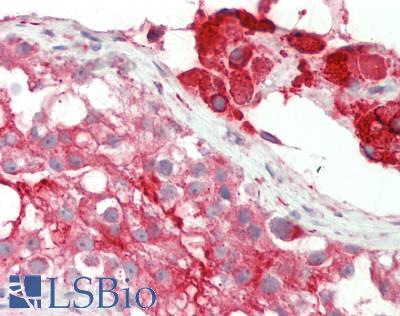 Human Testis: Formalin-Fixed, Paraffin-Embedded (FFPE)