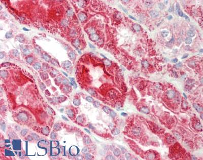 Human Kidney: Formalin-Fixed, Paraffin-Embedded (FFPE)