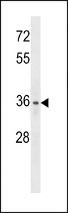 XLKD1 Antibody western blot of HL-60 cell line lysates (35 ug/lane). The XLKD1 antibody detected the XLKD1 protein (arrow).